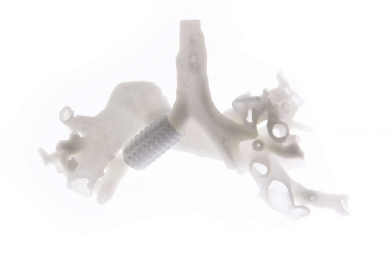 Stampa 3D e tecnica chirurgica